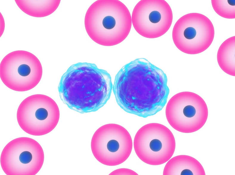 leukemia cells